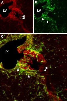 IHC-Fr analysis of mouse cerebrum tissue using GTX54816 CNGA2 antibody. Panel A : CNGA2 (red) appears in cells lining up the wall of the lateral ventricle (LV) (horizontal arrows). Panel B : Staining of astrocytes with mouse anti-glial fibrillary acidic protein (GFAP, green) demonstrates penetration of astrocytic fibers (vertical arrows) into the wall of the lateral ventricle. Panel C : Merge of panels A and B.