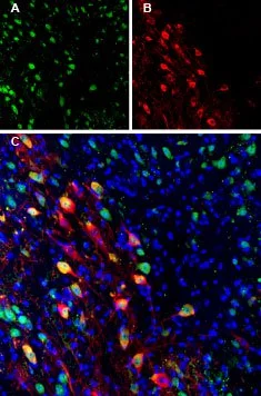 IHC-Fr analysis of mouse brain tissue using GTX54821 Ferroportin 1 antibody. Cell nuclei are stained using DAPI (blue). Panel A : Ferroportin staining (green) appears in several cells in the SNC. Panel B : Tyrosine hydroxylase (red) stains dopaminergic neurons. Panel C : Merge of A and B demonstrates Ferroportin in dopaminergic and non-dopaminergic neurons. IHC-Fr analysis of mouse brain tissue using GTX54821 Ferroportin 1 antibody. Cell nuclei are stained using DAPI (blue). Panel A : Ferroportin staining (green) appears in several cells in the SNC. Panel B : Tyrosine hydroxylase (red) stains dopaminergic neurons. Panel C : Merge of A and B demonstrates Ferroportin in dopaminergic and non-dopaminergic neurons.