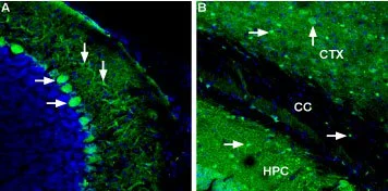 IHC-Fr analysis of mouse brain tissue using GTX54821 Ferroportin 1 antibody. Cell nuclei are stained using DAPI (blue). Panel A : In the cerebellum, Ferroportin (green) appears in cerebellar purkinje cells (horizontal arrows) and their dendrites (vertical arrows). Panel B : In the forebrain, intense Ferroportin appears (green) in oligodendrocytes (horizontal arrows) and moderate staining is detected in neurons (vertical arrow).