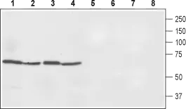 WB analysis of rat spleen (lanes 1 and 5), rat small intestine (lanes 2 and 6), rat liver (lanes 3 and 7), and mouse liver (lanes 4 and 8) lysates using GTX54821 Ferroportin 1 antibody preincubated with or without immunogen peptide. Dilution : 1:500