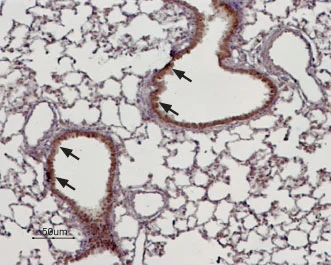 IHC-P analysis of rat lung tissue using GTX54863 TRPM4 antibody. TRPM4 is expressed in the respiratory epithelium of the bronchioli (arrows). Hematoxilin is used as the counterstain. Dilution : 1:100 IHC-P analysis of rat lung tissue using GTX54863 TRPM4 antibody. TRPM4 is expressed in the respiratory epithelium of the bronchioli (arrows). Hematoxilin is used as the counterstain. Dilution : 1:100