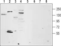 WB analysis of rat lung (lanes 1 and 5), rat heart membrane (lanes 2 and 6), mouse brain membrane (lanes 3 and 7), and ms1 cells (lanes 4 and 8) lysates using GTX54863 TRPM4 antibody preincubated with or without immunogen peptide. Dilution : 1:200