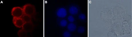 ICC/IF analysis of GH3 cells using GTX54865 TRPM7 antibody. Panel A : Primary antibody Panel B : DNA dye Hoechst 33342 Panel C : Live intact GH3 cells Dilution : 1:100 ICC/IF analysis of GH3 cells using GTX54865 TRPM7 antibody. Panel A : Primary antibody Panel B : DNA dye Hoechst 33342 Panel C : Live intact GH3 cells Dilution : 1:100