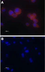 ICC/IF analysis of PFA-fixed PC-3 cells using GTX54868 TRPV5 antibody. Panel A : Primary antibody Panel B : Primary antibody prior incubated with immunogen peptide Dilution : 1:20 ICC/IF analysis of PFA-fixed PC-3 cells using GTX54868 TRPV5 antibody. Panel A : Primary antibody Panel B : Primary antibody prior incubated with immunogen peptide Dilution : 1:20