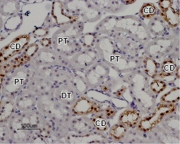 IHC-P analysis of rat kidney tissue using GTX54868 TRPV5 antibody. TRPV5 is expressed in collecting ducts (CD) in the renal cortex. Note that both proximal tubules (PT) and distal tubules (DT) are negative. Hematoxilin is used as the counterstain. Dilution : 1:100