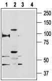 WB analysis of rat kidney (lanes 1 and 3) and PC3 cell line (lanes 2 and 4) lysates using GTX54868 TRPV5 antibody preincubated with or without immunogen peptide. Dilution : 1:200