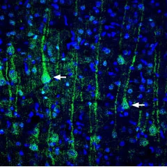 IHC-Fr analysis of rat cortex tissue using GTX54870 VGluT1 antibody. VGLUT1 (green) appears in neurons of the pyramidal layer of the parietal cortex (arrows). DAPI is used as the nuclear counterstain (blue). Dilution : 1:400 IHC-Fr analysis of rat cortex tissue using GTX54870 VGluT1 antibody. VGLUT1 (green) appears in neurons of the pyramidal layer of the parietal cortex (arrows). DAPI is used as the nuclear counterstain (blue). Dilution : 1:400