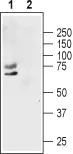 WB analysis of MCF-7 cell lysate using GTX54875 Kv1.1 antibody preincubated with or without immunogen peptide. Dilution : 1:200 WB analysis of MCF-7 cell lysate using GTX54875 Kv1.1 antibody preincubated with or without immunogen peptide. Dilution : 1:200