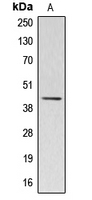 WB analysis of HUVEC (A) whole cell lysates using GTX54883 ACTBL2 antibody. WB analysis of HUVEC (A) whole cell lysates using GTX54883 ACTBL2 antibody.