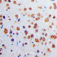 IHC-P analysis of formalin fixed human brain tissue section using GTX54886 Adenylate cyclase 1 antibody. Antigen retrieval : Heat mediated antigen retrieval with sodium citrate buffer (pH 6.0) IHC-P analysis of formalin fixed human brain tissue section using GTX54886 Adenylate cyclase 1 antibody. Antigen retrieval : Heat mediated antigen retrieval with sodium citrate buffer (pH 6.0)