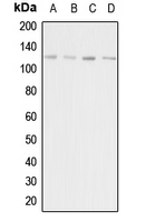 WB analysis of HeLa (A), HEK293T (B), mouse liver (C), rat kidney (D) whole cell lysates using GTX54886 Adenylate cyclase 1 antibody.