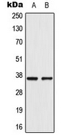 WB analysis of VEC (A), A549 (B) whole cell lysates using GTX54889 AKR1CL2 antibody.