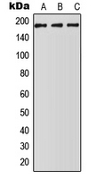 WB analysis of HepG2 (A), NIH3T3 (B), H9C2 (C) whole cell lysates using GTX54891 ABCA5 antibody. WB analysis of HepG2 (A), NIH3T3 (B), H9C2 (C) whole cell lysates using GTX54891 ABCA5 antibody.