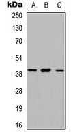WB analysis of HEK293T (A), Raw264.7 (B), H9C2 (C) whole cell lysates using GTX54900 ABHD13 antibody. WB analysis of HEK293T (A), Raw264.7 (B), H9C2 (C) whole cell lysates using GTX54900 ABHD13 antibody.
