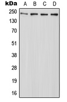 WB analysis of HeLa (A), Raw264.7 (B), mouse liver (C), PC12 (D) whole cell lysates using GTX54901 ABCA7 antibody. WB analysis of HeLa (A), Raw264.7 (B), mouse liver (C), PC12 (D) whole cell lysates using GTX54901 ABCA7 antibody.