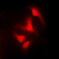 ICC/IF analysis of formalin-fixed K562 cells using GTX54905 c-Abl antibody. Red : Primary antibody Blue : DAPI Permeabilization : 0.1% Triton X-100 in TBS for 5-10 minutes
