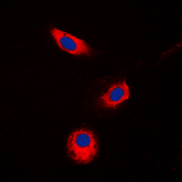 ICC/IF analysis of formalin-fixed Jurkat cells using GTX54911 AKR1B1 antibody. Red : Primary antibody Blue : DAPI Permeabilization : 0.1% Triton X-100 in TBS for 5-10 minutes