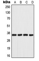 WB analysis of Jurkat (A), HeLa (B), SP2/0 (C), PC12 (D) whole cell lysates using GTX54911 AKR1B1 antibody.