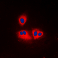 ICC/IF analysis of formalin-fixed K562 cells using GTX54912 ACOT2 antibody. Red : Primary antibody Blue : DAPI Permeabilization : 0.1% Triton X-100 in TBS for 5-10 minutes