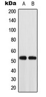 WB analysis of K562 (A), HT29 (B) whole cell lysates using GTX54912 ACOT2 antibody.