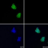 ICC/IF analysis of C6 cells using GTX54920 Aggrecan antibody. Red: Phalloidin Blue: DAPI
