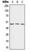 WB analysis of MDA-MB-231 (A), NIH3T3 (B), H9C2 (C) whole cell lysates using GTX54927 AKAP5 antibody.