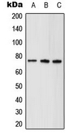 WB analysis of HeLa (A), mouse brain (B), rat kidney (C) whole cell lysates using GTX54936 ABCD1 antibody.