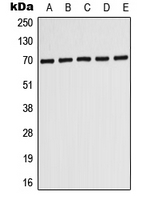 WB analysis of HepG2 (A), MCF7 (B), SH-SY5Y (C), SP2/0 (D), PC12 (E) whole cell lysates using GTX54937 PMP70 antibody.