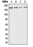 IHC-P analysis of formalin fixed human breast cancer tissue section using GTX54938 ACE antibody. Antigen retrieval : Heat mediated antigen retrieval with sodium citrate buffer (pH 6.0)