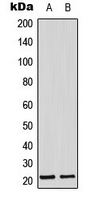 WB analysis of MCF7 (A), mouse lung (B) whole cell lysates using GTX54943 Adrenomedullin antibody.