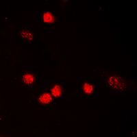 ICC/IF analysis of formalin-fixed HeLa cells using GTX54949 p53 (Acetyl Lys319) antibody. Red : Primary antibody Blue : DAPI Permeabilization : 0.1% Triton X-100 in TBS for 5-10 minutes