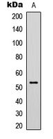 WB analysis of TSA-treated HeLa (A) whole cell lysates using GTX54949 p53 (Acetyl Lys319) antibody.