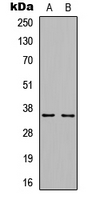 WB analysis of EGF-treated MCF7 (A), rat muscle (B) whole cell lysates using GTX54957 Cyclin D1 (phospho Thr286) antibody.
