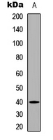 WB analysis of UV-treated HEK293T (A) whole cell lysates using GTX54960 PBK (phospho Thr9) antibody.