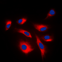 ICC/IF analysis of formalin-fixed K562 cells using GTX54969 MEK1/2 (phospho Ser222/Ser226) antibody. Red : Primary antibody Blue : DAPI Permeabilization : 0.1% Triton X-100 in TBS for 5-10 minutes