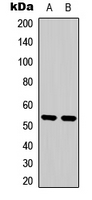 WB analysis of calyculin A-treated HeLa (A), MCF7 (B) whole cell lysates using GTX54979 PTEN (phospho Ser370) antibody.