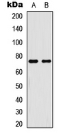 WB analysis of TNFa-treated HeLa (A), TNFa-treated HL60 (B) whole cell lysates using GTX54982 NFkB p65 (phospho Thr254) antibody.