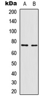 WB analysis of TNFa-treated Jurkat (A), TNFa-treated HepG2 (B) whole cell lysates using GTX54983 NFkB p65 (phospho Thr435) antibody.
