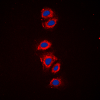 ICC/IF analysis of formalin-fixed HeLa cells using GTX54985 RPS6 (phospho Ser240) antibody. Red : Primary antibody Blue : DAPI Permeabilization : 0.1% Triton X-100 in TBS for 5-10 minutes ICC/IF analysis of formalin-fixed HeLa cells using GTX54985 RPS6 (phospho Ser240) antibody. Red : Primary antibody Blue : DAPI Permeabilization : 0.1% Triton X-100 in TBS for 5-10 minutes