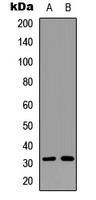 WB analysis of Anisomycin-treated Jurkat (A), SKOV3 (B) whole cell lysates using GTX54985 RPS6 (phospho Ser240) antibody.