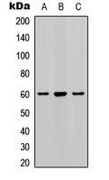 WB analysis of human kidney (A), mouse brain (B), rat brain (C) whole cell lysates using GTX54987 SMAD2 (phospho Ser467) antibody.