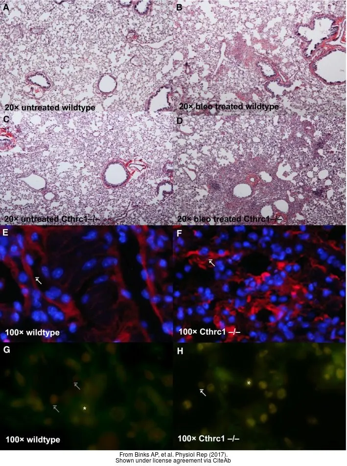 The data was published in the journal Physiol Rep in 2017. PMID: 28292882