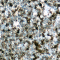IHC-P analysis of formalin fixed human lymph node tissue section using GTX55004 CBL (phospho Tyr700) antibody. Antigen retrieval : Heat mediated antigen retrieval with sodium citrate buffer (pH 6.0)