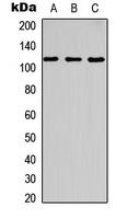 WB analysis of UV-treated HT29 (A), NIH3T3 (B), rat kidney (C) whole cell lysates using GTX55004 CBL (phospho Tyr700) antibody.