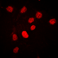 ICC/IF analysis of formalin-fixed HEK293T cells using GTX55008 C/EBP beta (phospho Thr235) antibody. Red : Primary antibody Blue : DAPI Permeabilization : 0.1% Triton X-100 in TBS for 5-10 minutes ICC/IF analysis of formalin-fixed HEK293T cells using GTX55008 C/EBP beta (phospho Thr235) antibody. Red : Primary antibody Blue : DAPI Permeabilization : 0.1% Triton X-100 in TBS for 5-10 minutes