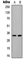 WB analysis of EGF-treated HEK293T (A), EGF-treated COLO205 (B) whole cell lysates using GTX55008 C/EBP beta (phospho Thr235) antibody.