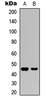 WB analysis of UV-treated HEK293T (A), rat kidney (B) whole cell lysates using GTX55012 GSK3 beta (phospho Ser9) antibody.