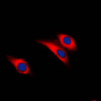 ICC/IF analysis of formalin-fixed HEK293T cells using GTX55015 Insulin Receptor beta (phospho Tyr1322) antibody. Red : Primary antibody Blue : DAPI Permeabilization : 0.1% Triton X-100 in TBS for 5-10 minutes ICC/IF analysis of formalin-fixed HEK293T cells using GTX55015 Insulin Receptor beta (phospho Tyr1322) antibody. Red : Primary antibody Blue : DAPI Permeabilization : 0.1% Triton X-100 in TBS for 5-10 minutes
