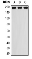 WB analysis of EGF-treated THP1 (A), EGF-treated Raw264.7 (B), rat liver (C) whole cell lysates using GTX55024 PDGF Receptor beta (phospho Tyr751) antibody. WB analysis of EGF-treated THP1 (A), EGF-treated Raw264.7 (B), rat liver (C) whole cell lysates using GTX55024 PDGF Receptor beta (phospho Tyr751) antibody.