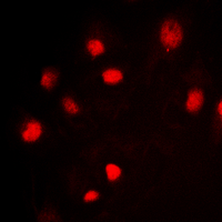 ICC/IF analysis of formalin-fixed Jurkat cells using GTX55031 Splicing factor 1 (phospho Ser82) antibody. Red : Primary antibody Blue : DAPI Permeabilization : 0.1% Triton X-100 in TBS for 5-10 minutes ICC/IF analysis of formalin-fixed Jurkat cells using GTX55031 Splicing factor 1 (phospho Ser82) antibody. Red : Primary antibody Blue : DAPI Permeabilization : 0.1% Triton X-100 in TBS for 5-10 minutes